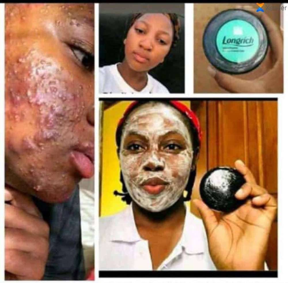 savon noir de gommage visage